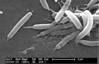 Helicobacter pylori. Image credit: CDC, wikimedia, 22 Nov 2012