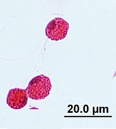 Phagocytes. Image credit: GC Lugo, wikimedia 22 Nov 2012
